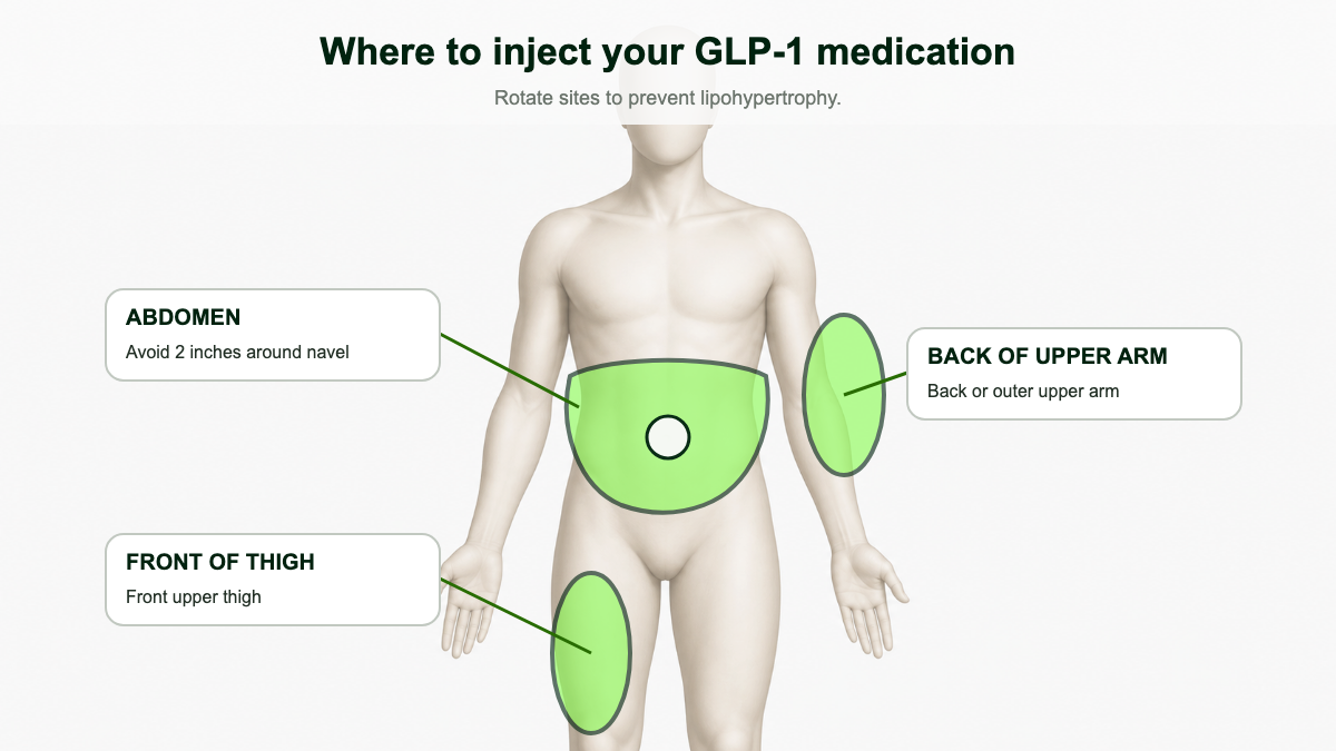 Front-facing torso silhouette showing three GLP-1 injection zones: abdomen excluding two inches around the navel, front of upper thigh, and back of upper arm.